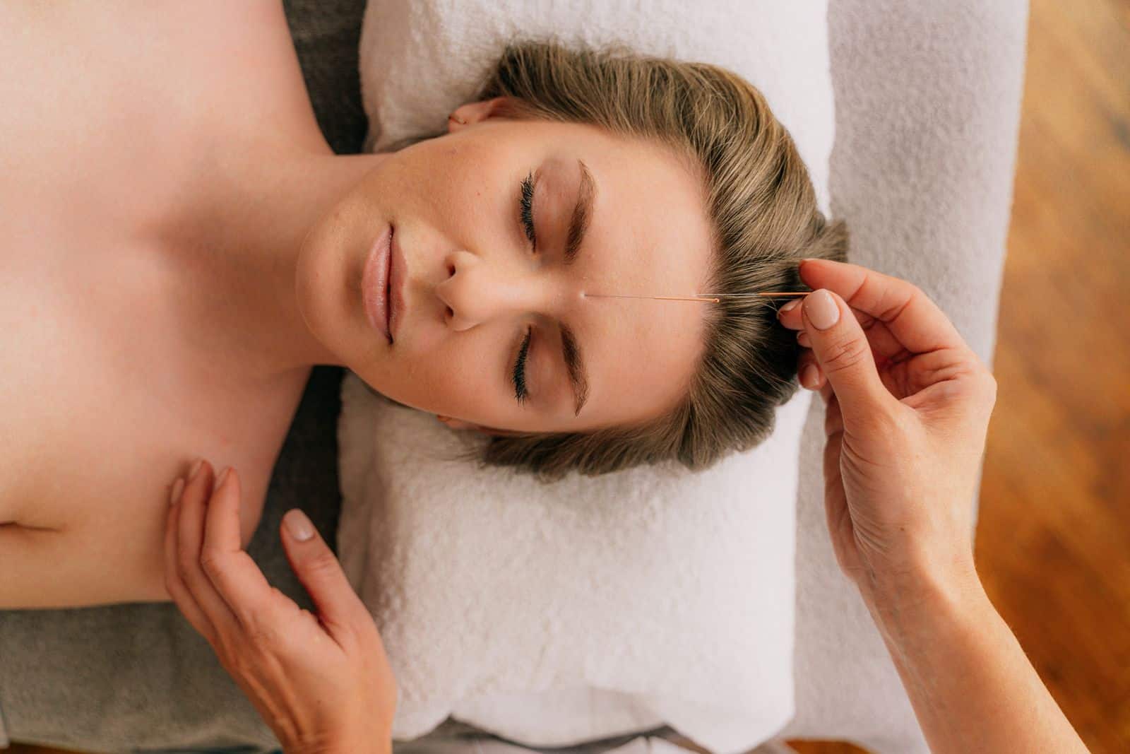 Kvinde modtager akupunktur som supplerende behandling ved fibromyalgi
